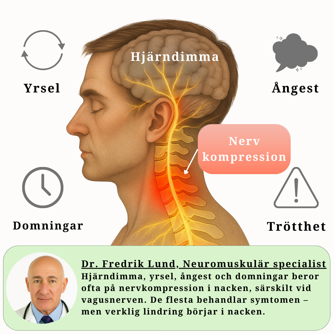 Illustration av nervkompression i nacken som orsakar nacksmärta, yrsel, hjärndimma och huvudvärk