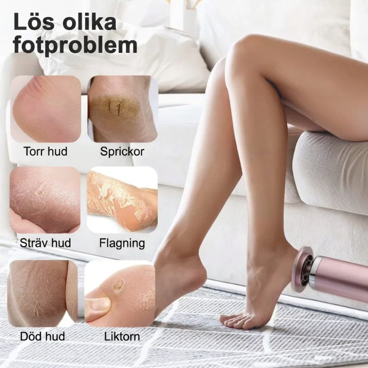 Exempel på fotproblem som torr hud, sprickor och liktorn som filen kan behandla