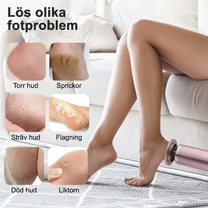 Exempel på fotproblem som torr hud, sprickor och liktorn som filen kan behandla